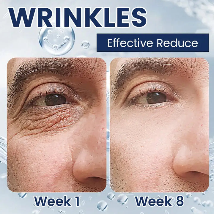 Ouhoe™ anti-rimpel verstevigende oogcrème