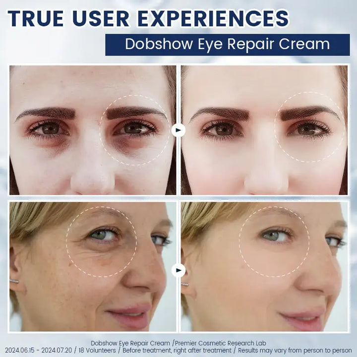 Ouhoe™ anti-rimpel verstevigende oogcrème